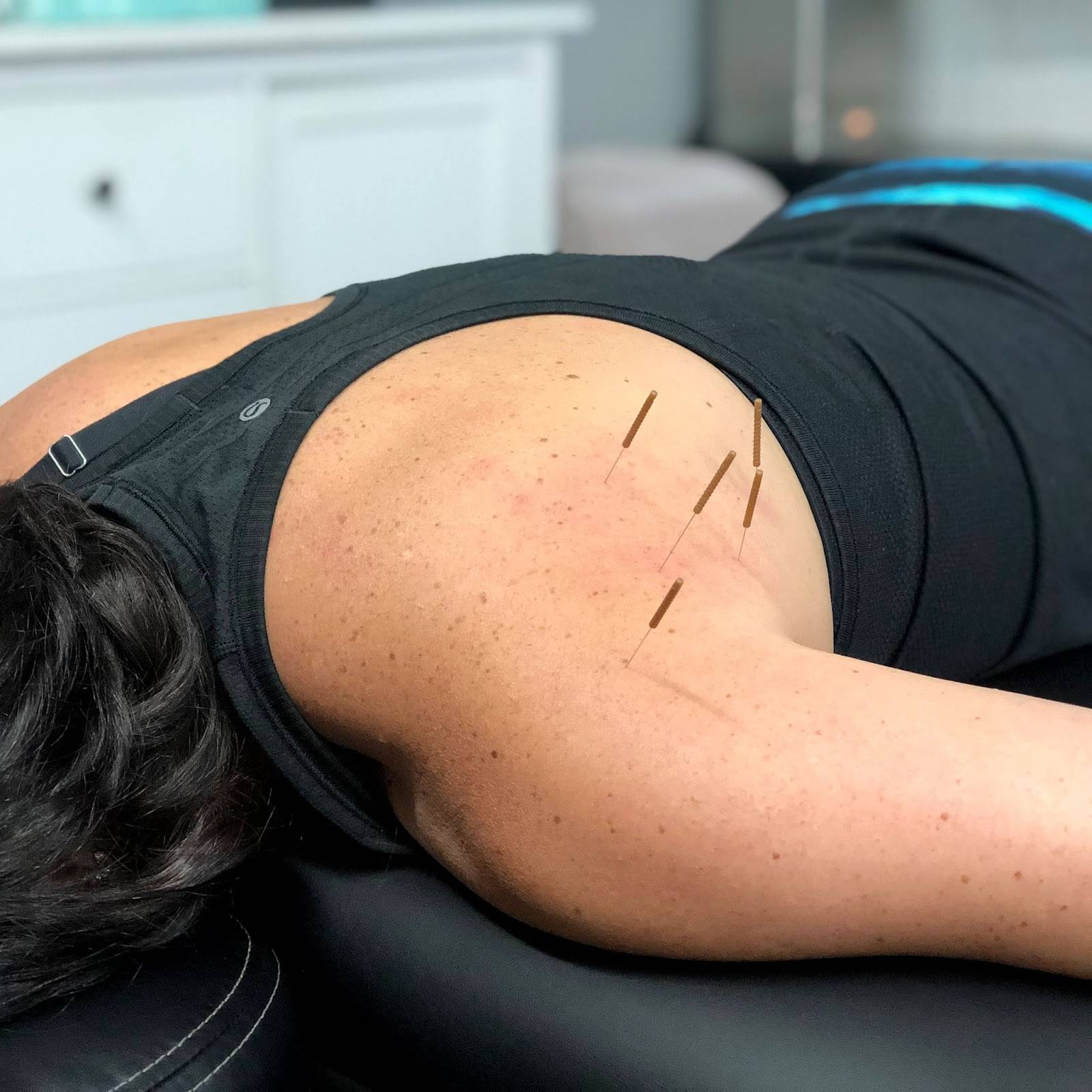 can dry needling cause more pain